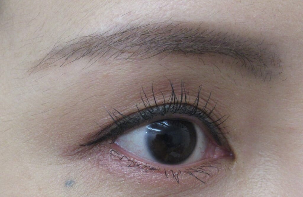 眉下切開とアートメイクをセットで考える危うさ｜傷跡や順番の考え方